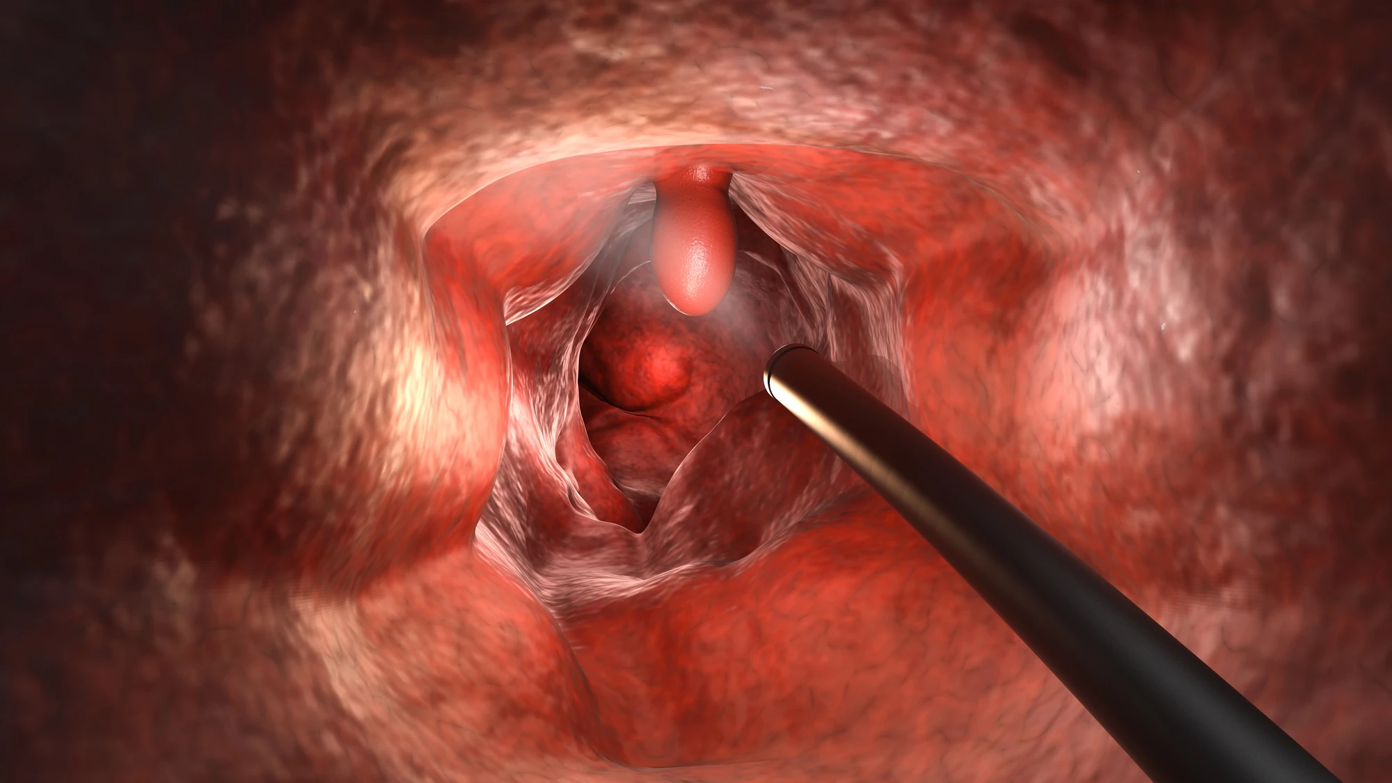 Imagem Coloproctologia