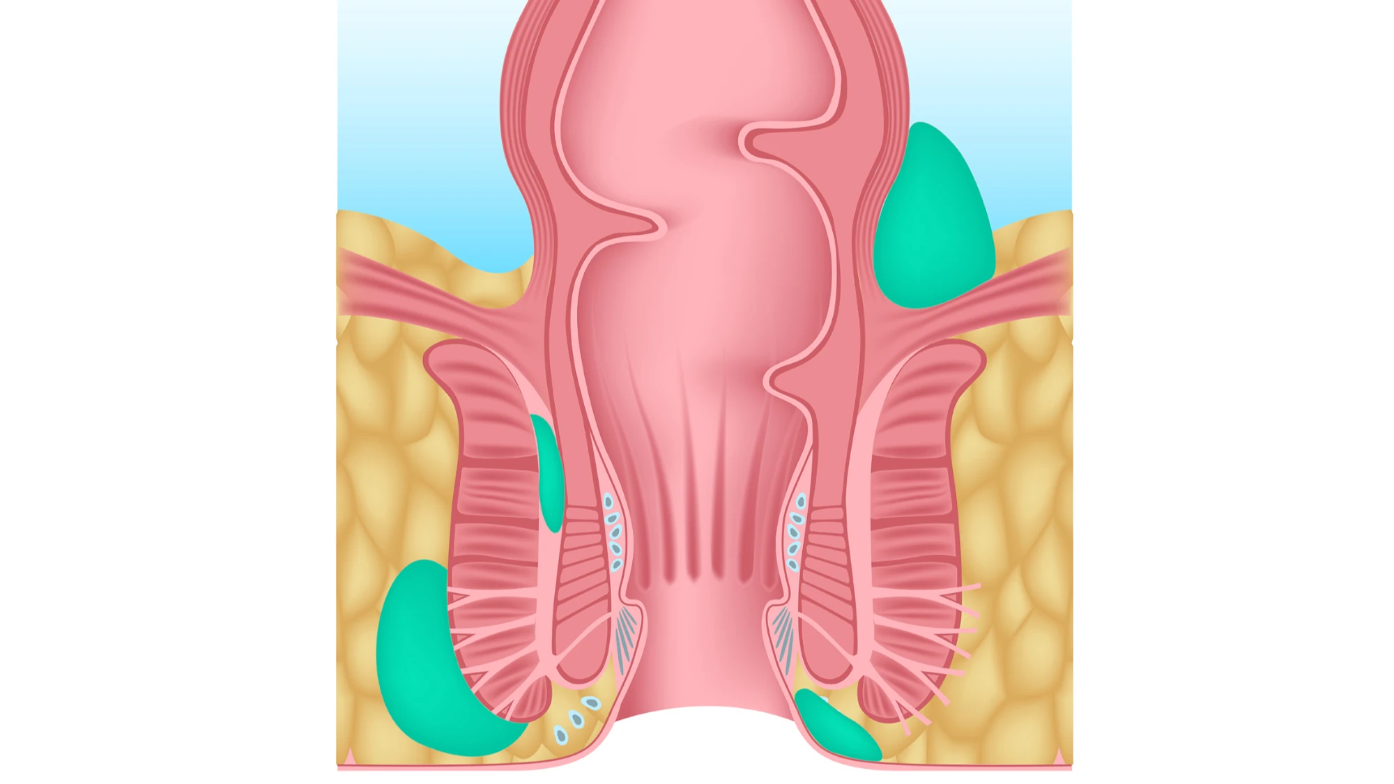 Imagem Coloproctologia